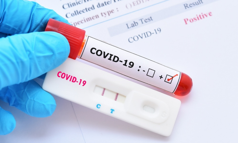 Por: Cortesía La OMS estudia una nueva variante de coronavirus detectada en Colombia