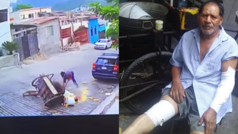 Por: Cortesía Elotero resbala, tira su mercancía y sufre quemaduras; usuarios en redes se unen para ayudarlo