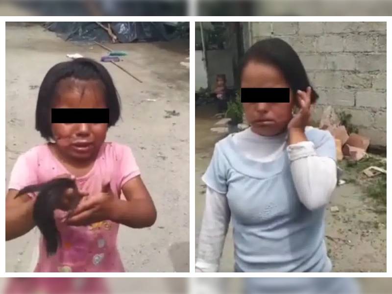 Por: Cortesía Abuela quema el rostro de su nieta e hija con síndrome de Down en Puebla, autoridades ya investigan (Video)