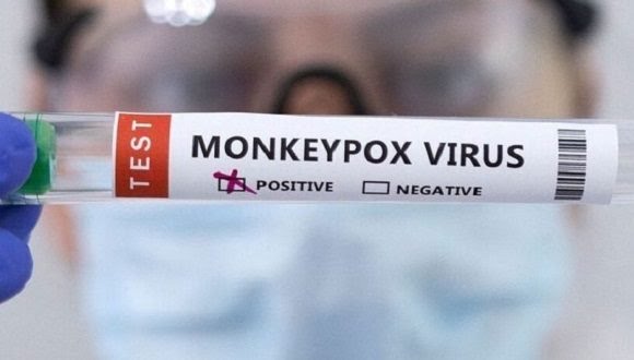 Por: Cortesía Confirma Cuba su primer caso de viruela del mono