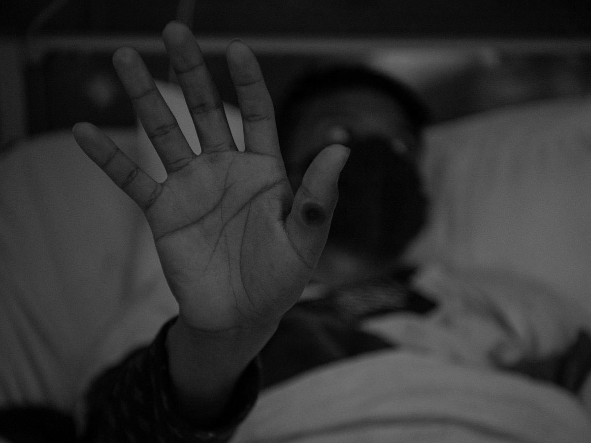 Por: Cortesía Fallece italiano de quien se reportó el primer caso de viruela símica en Cuba