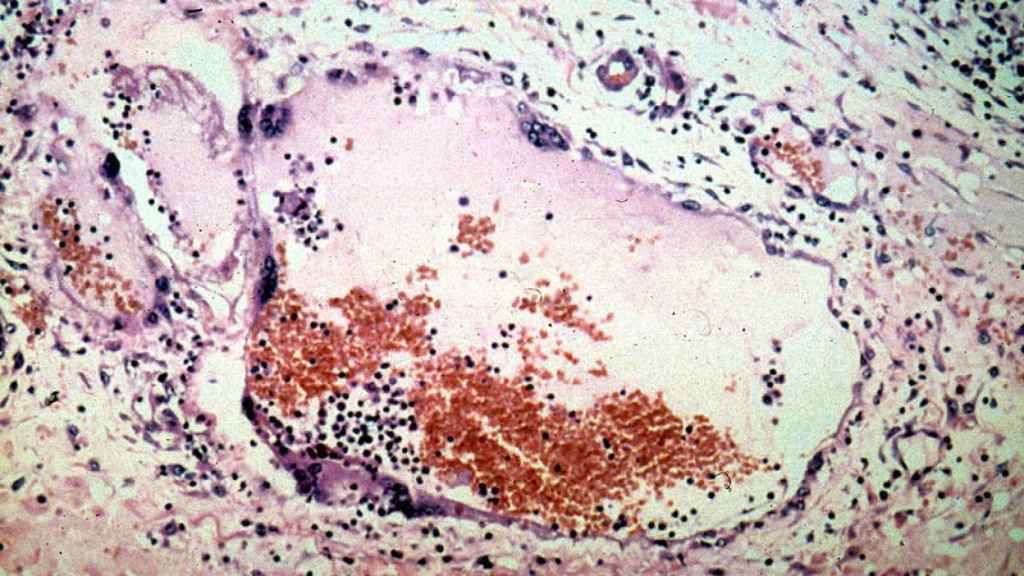 Por: Cortesía ¡Otro virus!: detectan en China 35 casos de henipavirus, un nuevo virus de origen animal