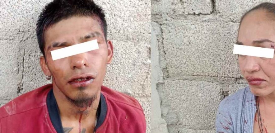 Lesionan con machete a joven al resistirse a un asalto en Amozoc 