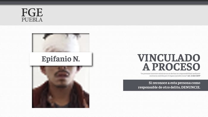 detenido cabeza2