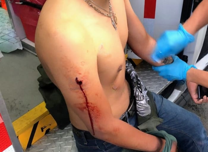 baleado clavijero
