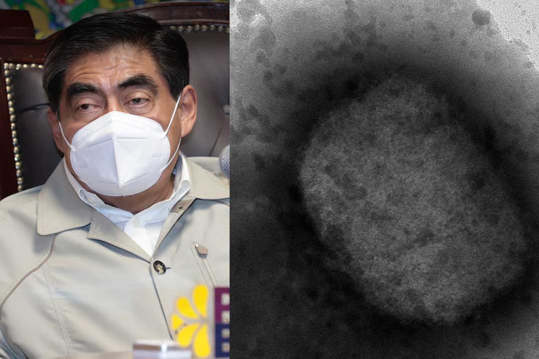 Por: Cortesía Puebla confirma sus dos primeros casos de viruela del mono