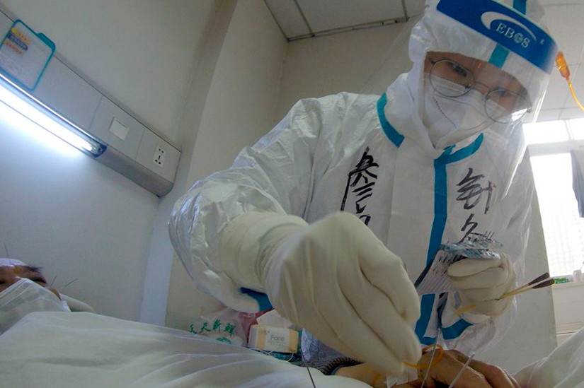 Por: Cortesía Autoridades en China incluyen la acupuntura en protocolo actualizado contra Covid-19