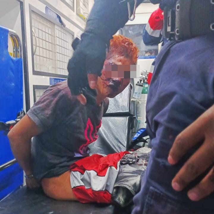 Pedía clemencia: presunto ladrón detenido y golpeado, en Acuamanala