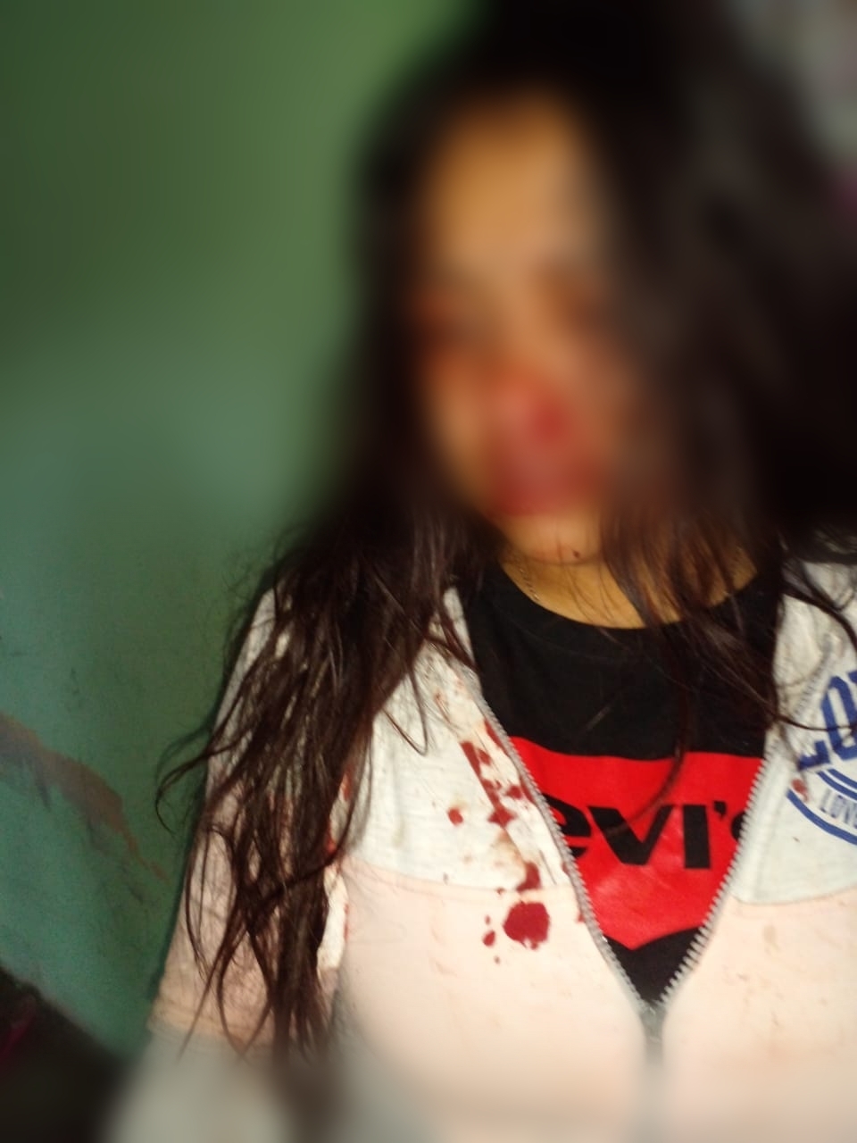 Por: Cortesía Surgen anomalías en caso de agresión a jóvenes hermanos ocurrida en Tlaxco; Juez desestimó pruebas