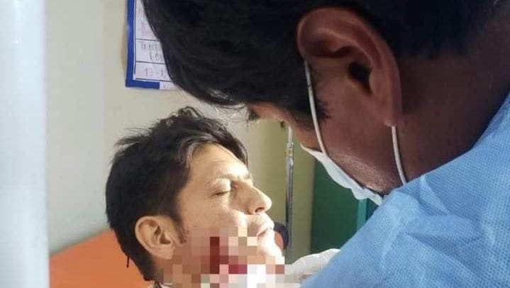 Por: Cortesía “El Zapata” salva la vida tras cirugía facial