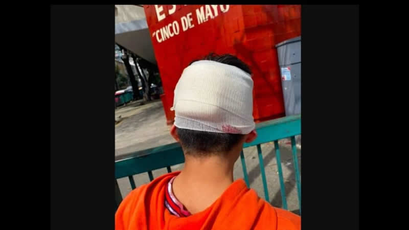 Por: Cortesía “Ellos me empujaron”: Niño apuñaló a compañero de secundaria con un desarmador
