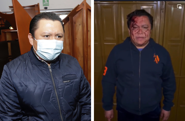 Por: Cortesía Líder del sindicato del Ayuntamiento de Puebla denuncia ataque