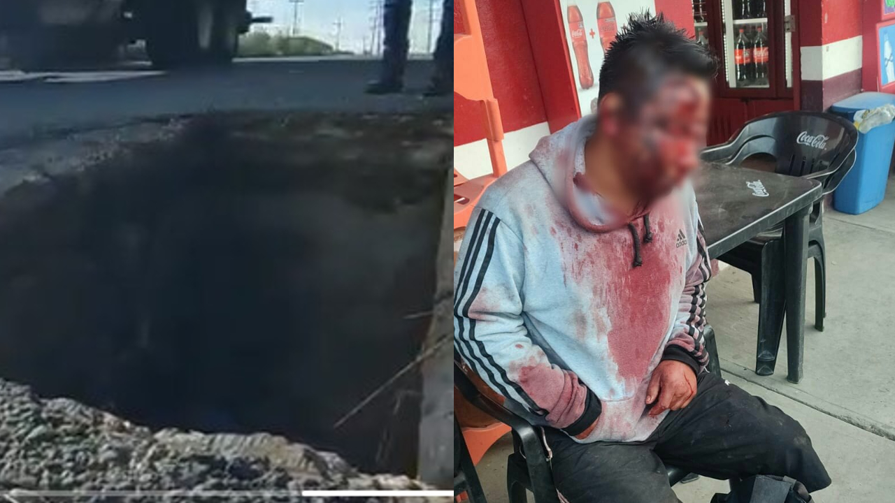 Por: Cortesía En Cuautlancingo; un ciclista resultó gravemente lesionado al caer en un registro sin tapa