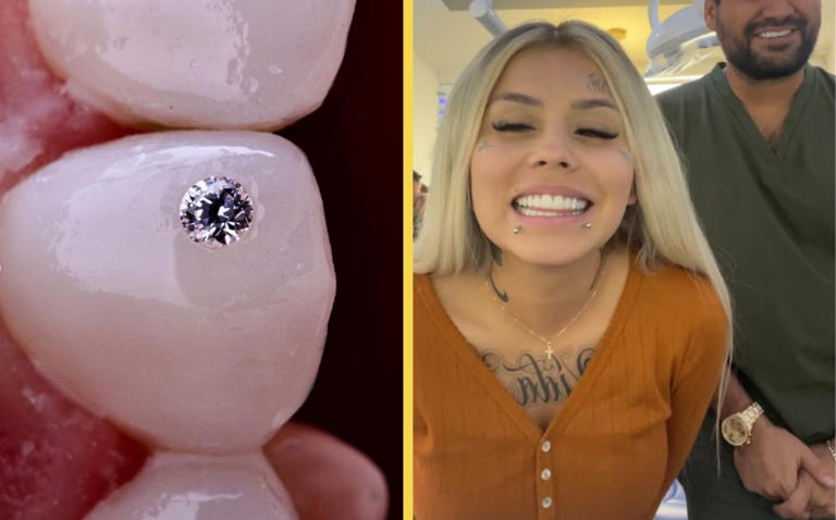 ¡Gasto casi 300 mil pesos!: Mona presume nuevos dientes con incrustaciones de diamantes (Vídeo)