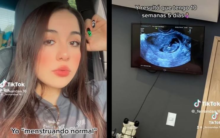 Joven se entera que está embarazada por casualidad; ella seguía menstruando con normalidad (Vídeo)