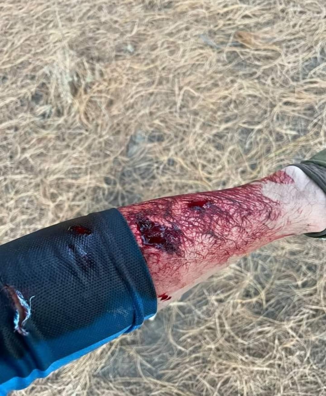 Por: Cortesía Lula Pineda Solo un caso de ataque canino se tiene reportado en el cerro Zapotecas en lo que va de la administración