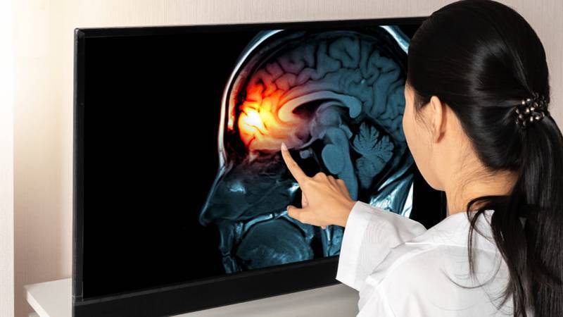 Por: Cortesía Meningitis en Durango: Detienen a anestesiólogo y otras dos personas por los contagios