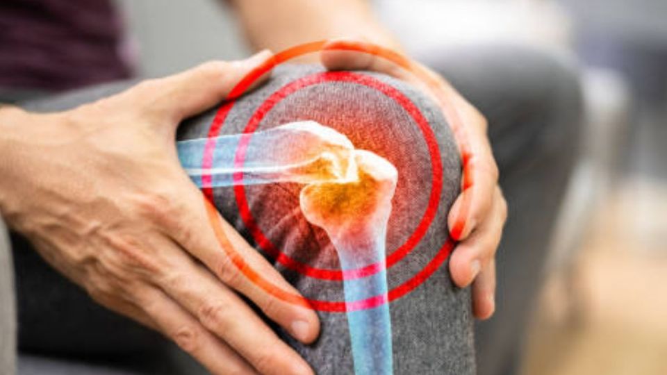 Por: Cortesía Conoce el alimento ideal para recuperar colágeno y regenerar el cartílago de las rodillas