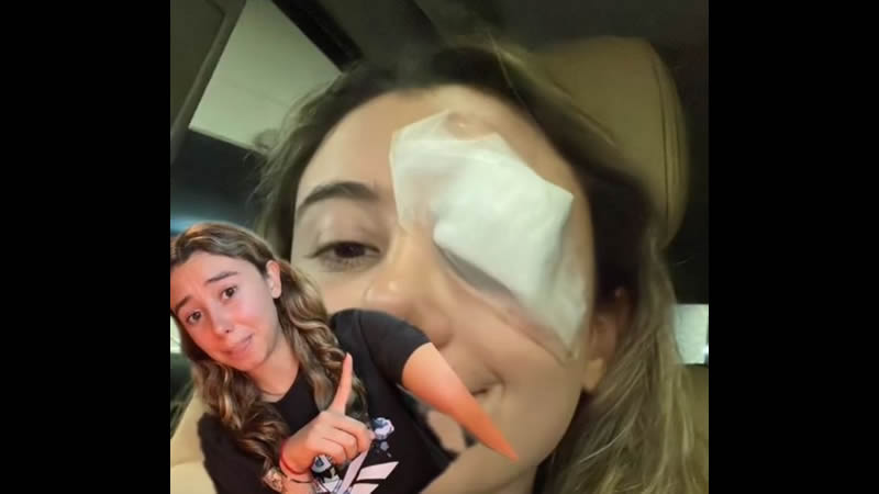 Por: Cortesía Mujer terminó con una bola gigante en el párpado por seguir consejo que vio en TikTok (Vídeo)