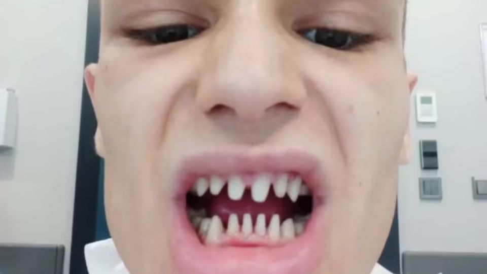 Por: Cortesía Sujeto acude a especialista por un diseño de sonrisa, le cobraron 65 mil pesos y terminó con "dientes de tiburón"