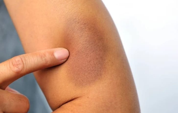 Departamento de Atención a la Mujer de SPCH otorga apoyo entre 6 a 7 mujeres víctimas de maltrato diariamente