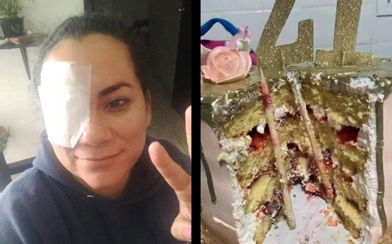 Por: Cortesía Mujer estuvo a punto de perder un ojo tras ser empujada a su pastel de cumpleaños (Vídeo)
