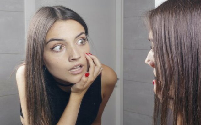Deshacerse de las espinillas con 5 remedios naturales