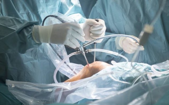 Artroscopia de rodilla: ¿cuáles son sus beneficios?