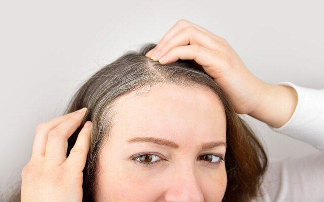 ¿Qué alimentos nos ayudan a retardar las canas?