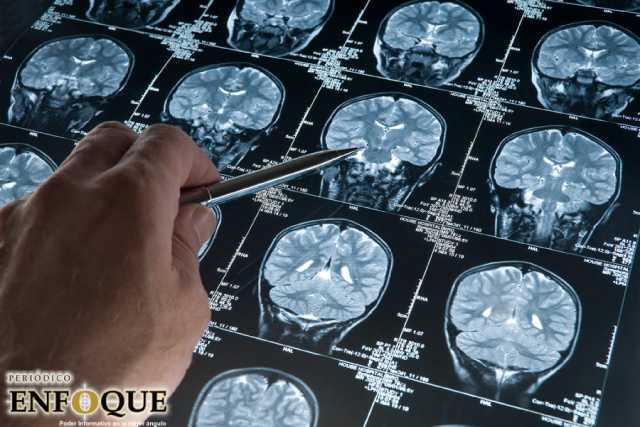 Foto: Cortesía  800 Mil personas padecen alzheimer en méxico, según unam