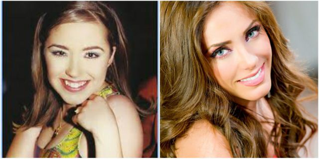 Por: Cortesía Anahí y su evolución física: ¿Qué cirugías ha realizado a lo largo del tiempo?